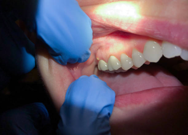 Best Pediatric Emergency Dentist in Whitney, SC